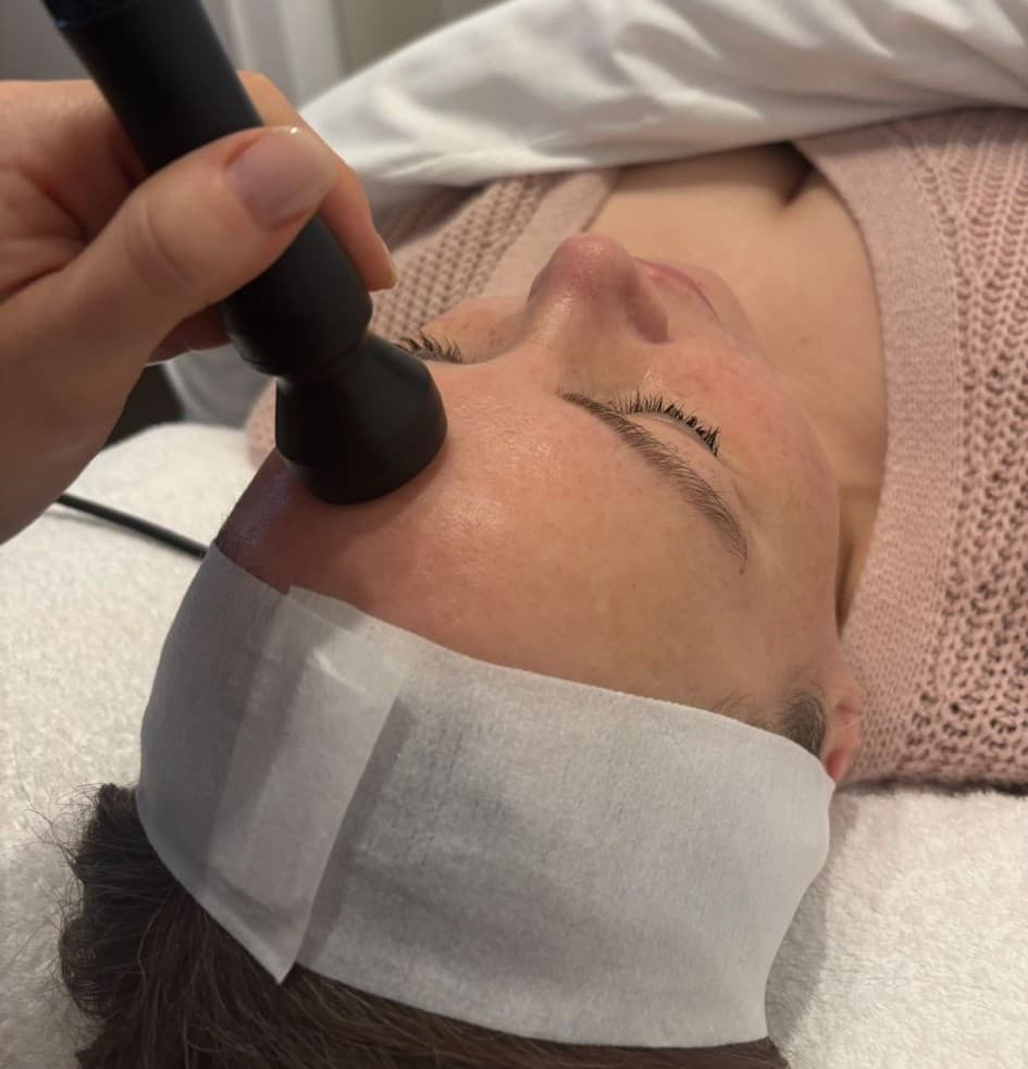 Radiofrequency skin tightening treatment at SANCTUM